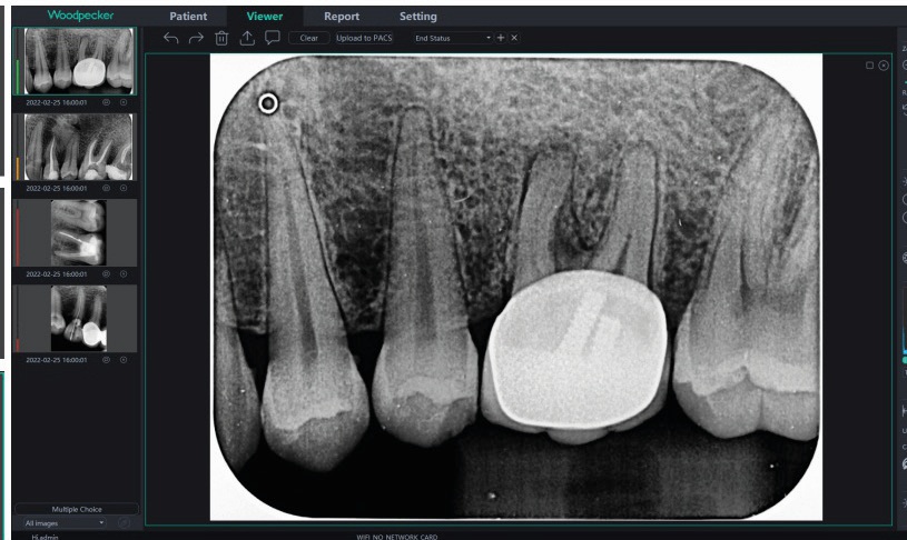 WoodPecker Free Scan - high performance